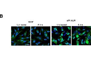 Silencing PLAUR affects proteins involved in DNA metabolism, synthesis and repair(A) Gene interacting networks generated using IPA showing the interacting genes and biological processes involving metabolism and incorporation of nucleotides, (B) MDA-MB-231 cells silenced for PLAUR were irradiated at 9 Gy, after 6 h cells were fixed and stained for 8-OHdG antibody. (8-OHDG 抗体)