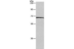 Western Blot analysis of Human normal liver tissue using HSF27 Polyclonal Antibody at dilution of 1:655 (CDK5RAP3 抗体)