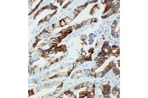 Immunohistochemistry (IHC) image for anti-Cytochrome P450, Family 2, Subfamily U, Polypeptide 1 (CYP2U1) (AA 457-473), (C-Term) antibody (ABIN3044054)