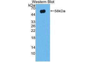 Western Blotting (WB) image for anti-Taxilin alpha (TXLNA) (AA 1-234) antibody (ABIN1980518) (alpha Taxilin 抗体  (AA 1-234))
