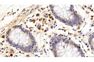 Detection of IL7R in Human Rectum Tissue using Polyclonal Antibody to Interleukin 7 Receptor (IL7R)
