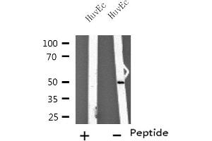 Western blot analysis of extracts from HuvEc cells using TUBA3C/E antibody. (TUBA3C/E 抗体)