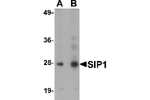 Western Blotting (WB) image for anti-Gem (Nuclear Organelle) Associated Protein 2 (GEMIN2) (C-Term) antibody (ABIN1030662) (SIP1 抗体  (C-Term))