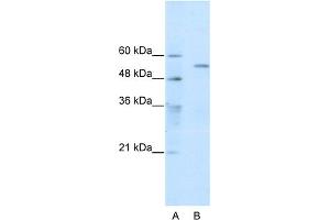 WB Suggested Anti-TRIM35 Antibody Titration:  0. (TRIM35 抗体  (C-Term))
