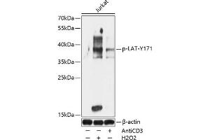 Western blot analysis of extracts of Jurkat cells, using Phospho-LAT-Y171 antibody (ABIN7268273) at 1:1000 dilution.