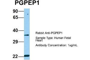 Host: Rabbit  Target Name: PGPEP1  Sample Tissue: Human Fetal Heart  Antibody Dilution: 1. (PGPEP1 抗体  (N-Term))