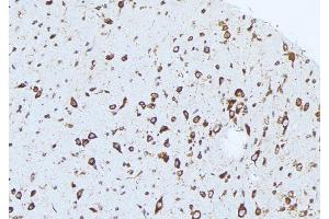 ABIN6276418 at 1/100 staining Mouse brain tissue by IHC-P. (Caspase 1 抗体  (C-Term))