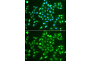 Immunofluorescence analysis of A549 cell using UCHL5 antibody. (UCHL5 抗体)