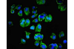 Immunofluorescent analysis of MCF-7 cells using ABIN7174192 at dilution of 1:100 and Alexa Fluor 488-congugated AffiniPure Goat Anti-Rabbit IgG(H+L) (LSM4 抗体  (AA 1-139))