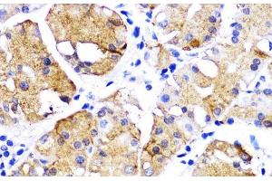 Immunohistochemistry (Paraffin-embedded Sections) (IHC (p)) image for anti-Bone Morphogenetic Protein Receptor, Type IB (BMPR1B) antibody (ABIN7260047)