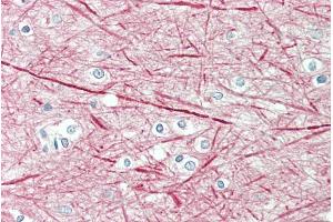ABIN571056 (5µg/ml) staining of paraffin embedded Human Cortex. (NEFM 抗体  (Internal Region))