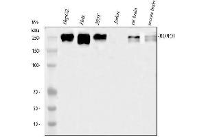 Western blot analysis of ROBO1 using anti-ROBO1 antibody (ABIN6719615).