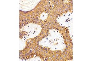 Paraformaldehyde-fixed, paraffin embedded human skin tissue, Antigen retrieval by boiling in sodium citrate buffer (pH6. (RAC1 抗体)
