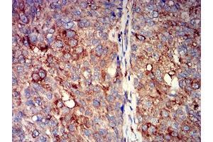 Immunohistochemistry (IHC) image for anti-Cholinergic Receptor, Nicotinic, alpha 7 (Neuronal) (CHRNA7) (AA 52-259) antibody (ABIN5611363)