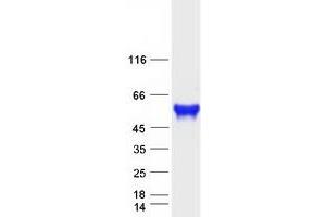 Western Blotting (WB) image for Cytokine Receptor-Like Factor 3 (CRLF3) protein (Myc-DYKDDDDK Tag) (ABIN2712564)
