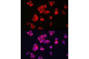 Immunofluorescence analysis of HepG2 cells using TFR2 Rabbit pAb (ABIN6128863, ABIN6149063, ABIN6149064 and ABIN6225172) at dilution of 1:100 (40x lens). (Transferrin Receptor 2 抗体  (AA 582-801))
