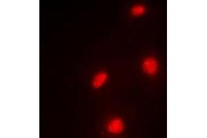 Immunofluorescent analysis of MTF-2 staining in A549 cells. (MTF2 抗体)
