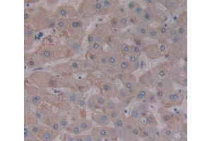 Used in DAB staining on fromalin fixed paraffin- embedded liver tissue (PPFIA1 抗体  (AA 1-250))