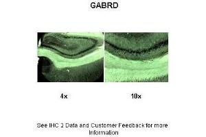 Sample Type :  Rat brain section  Primary Antibody Dilution :  1:1000  Secondary Antibody :  Anti-rabbit-biotin, streptavidin-diaminobenzidine  Secondary Antibody Dilution :  1:500  Gene Name :  GABRD  Submitted by :  Dr. (GABRD 抗体  (N-Term))