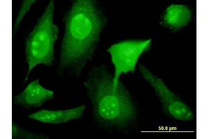 Immunofluorescence of monoclonal antibody to YY1AP1 on HeLa cell. (YY1AP1 抗体  (AA 1-739))