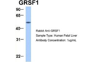 Host:  Rabbit  Target Name:  GRSF1  Sample Type:  Human Fetal Liver  Antibody Dilution:  1. (GRSF1 抗体  (Middle Region))