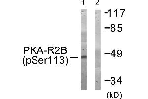 Western blot analysis of extracts from COS-7 cells, treated with A (125 ng/mL, 30 mins), using PKA-R2β (Phospho-Ser113) antibody. (PRKAR2B 抗体  (pSer113))
