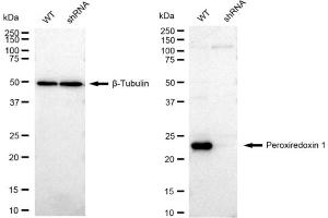 Western blotting analysis using Peroxiredoxin 1 antibody (ABIN7799776). (Recombinant Peroxiredoxin 1 抗体)