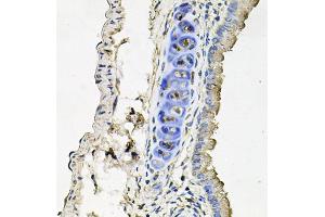 Immunohistochemistry of paraffin-embedded mouse lung using SLC39A4 antibody (ABIN5971796) at dilution of 1/100 (40x lens). (SLC39A4 抗体)