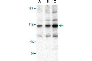 Western blot analysis of TRAF2 in mouse liver tissue lysate with TRAF2 polyclonal antibody  at (A) 0. (TRAF2 抗体  (C-Term))