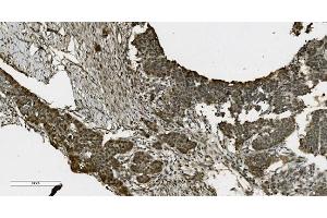 IHC analysis of PARP using anti-PARP antibody (ABIN7602276). (PARP1 抗体  (AA 670-858))