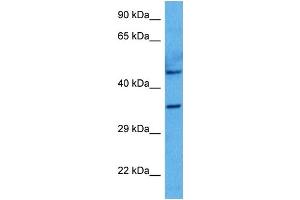 Western Blotting (WB) image for anti-SRY (Sex Determining Region Y)-Box 2 (SOX2) (N-Term) antibody (ABIN2777428)