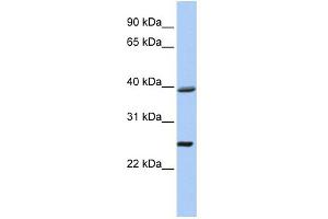 WB Suggested Anti-C12orf42 Antibody Titration: 0. (C12orf42 抗体  (N-Term))