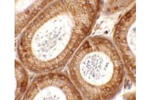Immunohistochemistry of SPATA6 in mouse testis tissue with SPATA6 antibody at 2. (SPATA6 抗体  (C-Term))
