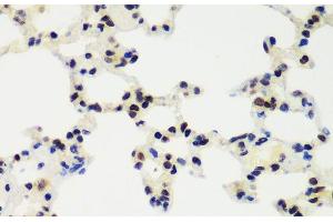 Immunohistochemistry of paraffin-embedded Rat lung using RNF2 Polyclonal Antibody at dilution of 1:100 (40x lens). (RNF2 抗体)