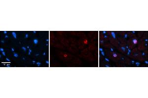 Rabbit Anti-LBX1 Antibody    Formalin Fixed Paraffin Embedded Tissue: Human Adult heart  Observed Staining: Nuclear (rare) Primary Antibody Concentration: 1:600 Secondary Antibody: Donkey anti-Rabbit-Cy2/3 Secondary Antibody Concentration: 1:200 Magnification: 20X Exposure Time: 0. (Lbx1 抗体  (N-Term))