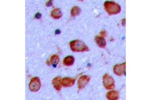 Immunohistochemical analysis of GPR119 staining in human brain formalin fixed paraffin embedded tissue section. (G Protein-Coupled Receptor 119 抗体  (Center))