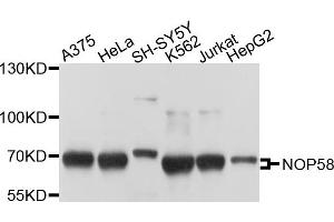 Western blot analysis of extracts of various cells, using NOP58 antibody. (NOP58 抗体)