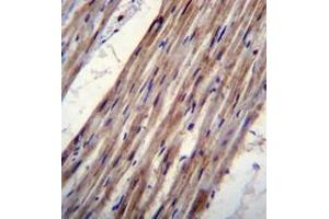 Immunohistochemistry analysis in formalin fixed and paraffin embedded human heart tissue reacted with KCNJ8 Antibody (N-term) followed which was peroxidase conjugated to the secondary antibody and followed by DAB staining. (KCNJ8 抗体  (N-Term))