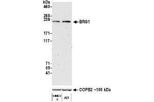 Western Blotting (WB) image for anti-SWI/SNF Related, Matrix Associated, Actin Dependent Regulator of Chromatin, Subfamily A, Member 4 (SMARCA4) (AA 75-125) antibody (ABIN7453997)