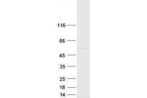 Western Blotting (WB) image for Cytochrome P450, Family 2, Subfamily R, Polypeptide 1 (CYP2R1) protein (Myc-DYKDDDDK Tag) (ABIN2712772)