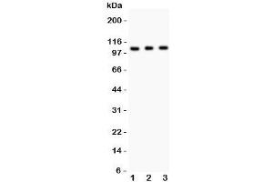 Western blot testing of GRIK1 antibody and Lane 1:  mouse brain;  2: mouse brain;  3: human SHG-44 (glioma) lysate. (GRIK1 抗体  (AA 271-450))