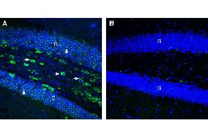 Expression of CCKBR in mouse hippocampus.