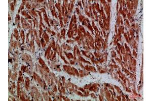 Immunohistochemical analysis of paraffin-embedded Human-heart, antibody was diluted at 1:100