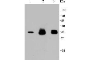 Lane 1: HeLa Cell lysates, Lane 2: PC12 Cell lysates, Lane 3: SH-SY5Y Cell lysates,probed with Cyclin D1 (2H4) Monoclonal Antibody  at 1:1000 overnight at 4˚C. (Cyclin D1 抗体)