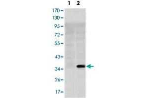 Western blot analysis using SLC22A1 monoclonal antobody, clone 2C5  against HEK293 (1) and SLC22A1-hIgGFc transfected HEK293 (2) cell lysate. (SLC22A1 抗体)
