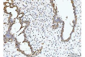 IHC analysis of BCKDK using anti-BCKDK antibody (ABIN7601470).
