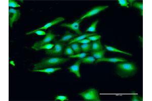 Immunofluorescence of purified MaxPab antibody to GUCA1C on HeLa cell. (GUCA1C 抗体  (AA 1-209))
