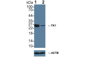 Knockout Varification: ;Lane 1: Wild-type 293T cell lysate; ;Lane 2: TK1 knockout 293T cell lysate; ;Predicted MW: 25kDaa ;Observed MW: 26kDa;Primary Ab: 3µg/ml Rabbit Anti-Human TK1 Antibody;Second Ab: 0. (TK1 抗体  (AA 2-234))