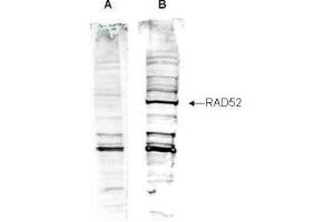 Western blot analysis is shown using  Affinity Purified anti-Human RAD52 antibody to detect Human RAD52 present in a HeLa nuclear extract (panel B).