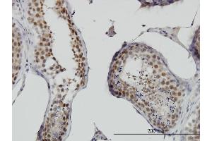 Immunostaining (ISt) image for anti-Ring Finger Protein 141 (RNF141) (AA 141-229) antibody (ABIN565506)